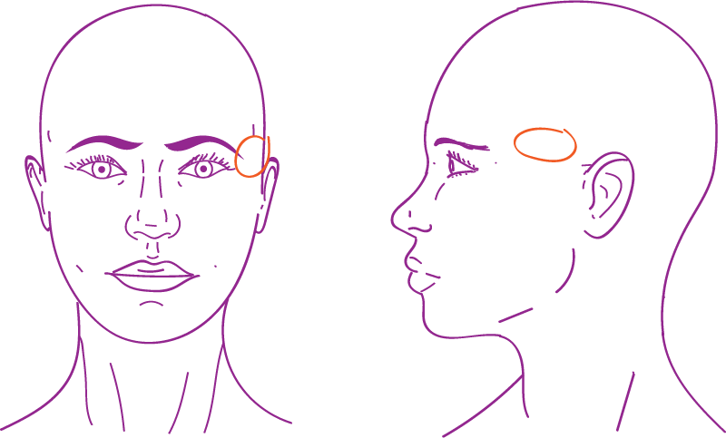 image of a head showing temples location